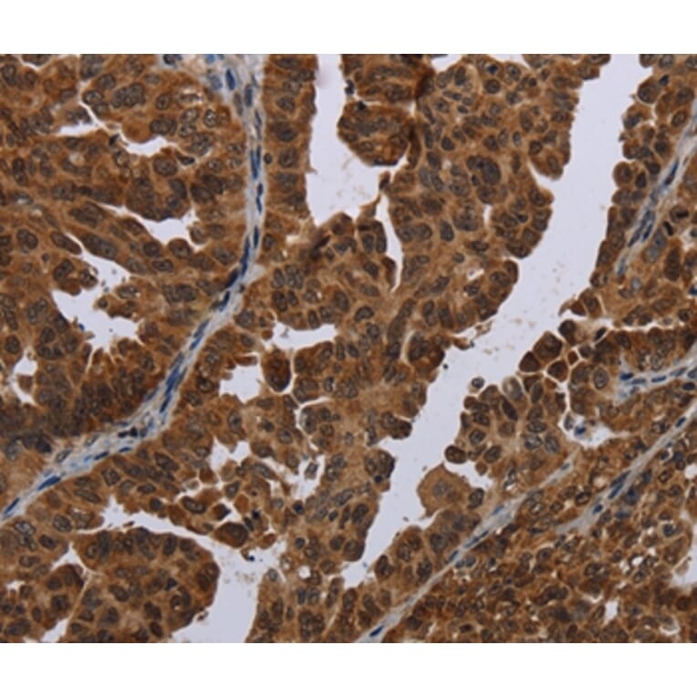 Immunohistochemistry - MAGEB3 Antibody from Signalway Antibody (37707) - Antibodies.com