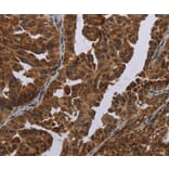 Immunohistochemistry - MAGEB3 Antibody from Signalway Antibody (37707) - Antibodies.com
