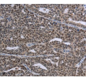 Immunohistochemistry - MAGEC1 Antibody from Signalway Antibody (37709) - Antibodies.com