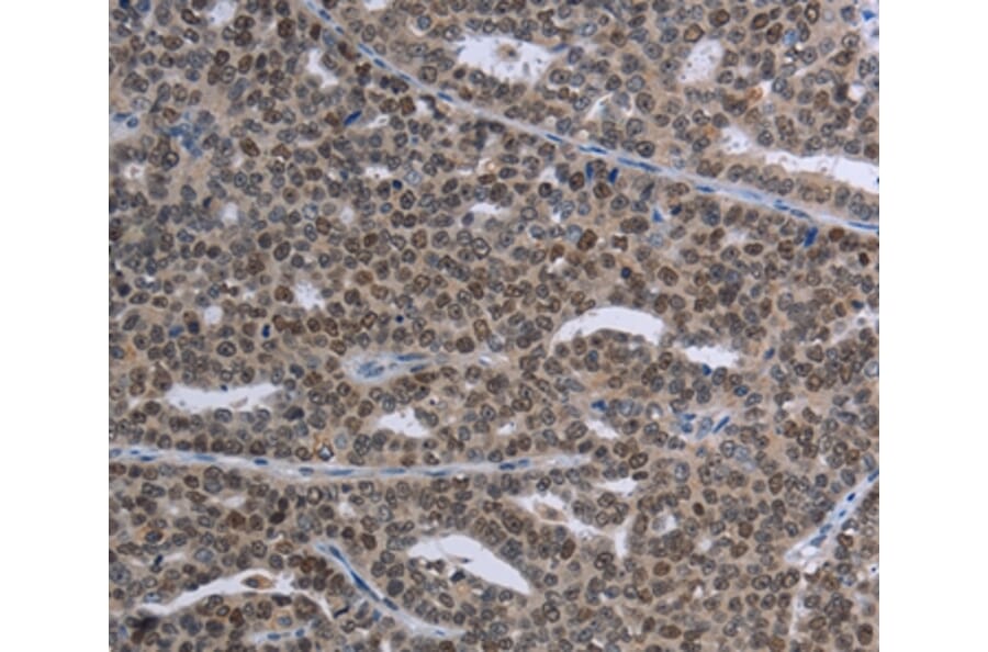 Immunohistochemistry - MAGEC1 Antibody from Signalway Antibody (37709) - Antibodies.com