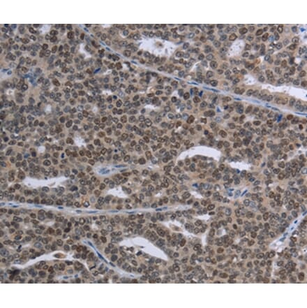 Immunohistochemistry - MAGEC1 Antibody from Signalway Antibody (37709) - Antibodies.com