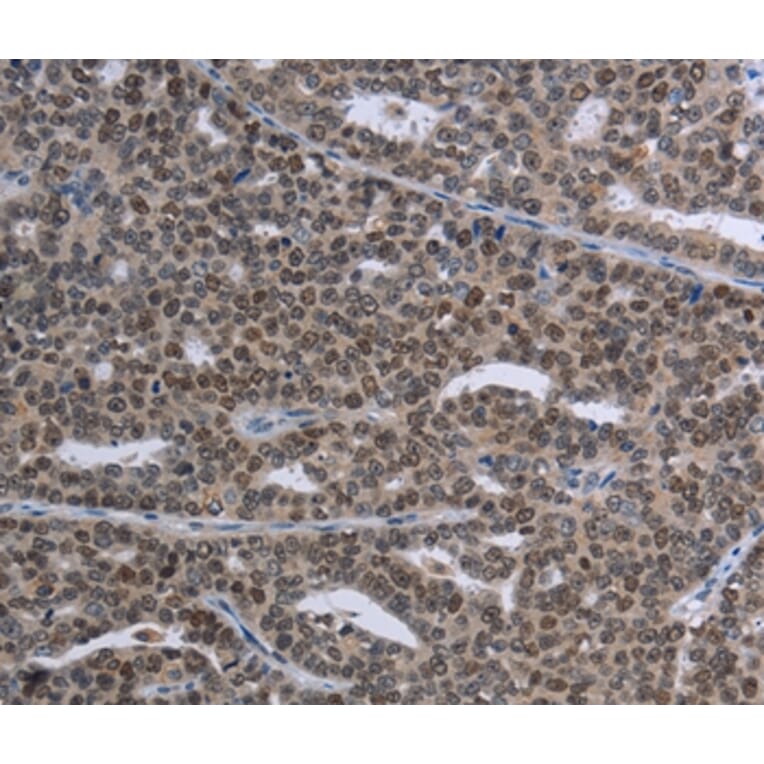 Immunohistochemistry - MAGEC1 Antibody from Signalway Antibody (37709) - Antibodies.com