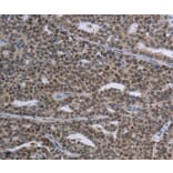 Immunohistochemistry - MAGEC1 Antibody from Signalway Antibody (37709) - Antibodies.com