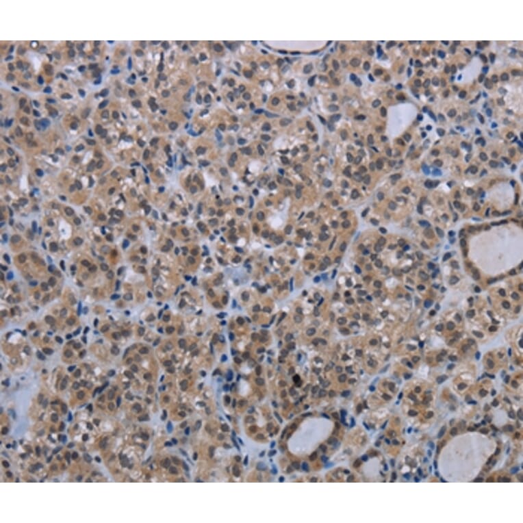 Immunohistochemistry - MAGEC1 Antibody from Signalway Antibody (37709) - Antibodies.com