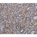 Immunohistochemistry - MAGEC1 Antibody from Signalway Antibody (37709) - Antibodies.com