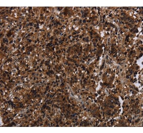 Immunohistochemistry - MAGEE1 Antibody from Signalway Antibody (37710) - Antibodies.com