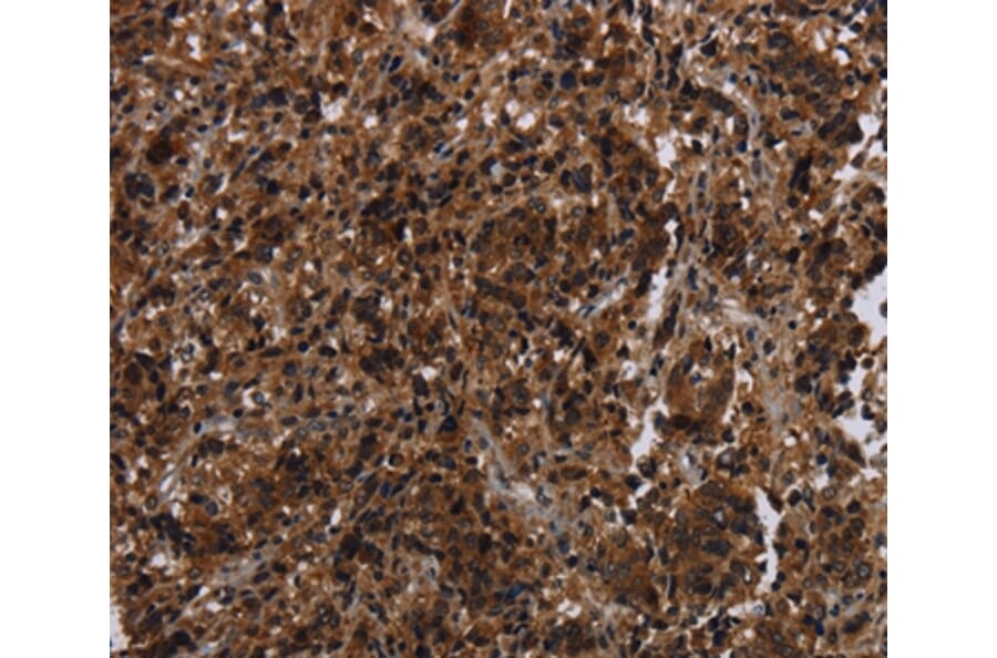 Immunohistochemistry - MAGEE1 Antibody from Signalway Antibody (37710) - Antibodies.com