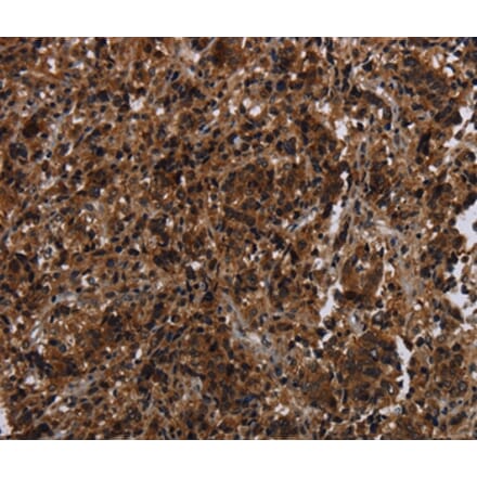 Immunohistochemistry - MAGEE1 Antibody from Signalway Antibody (37710) - Antibodies.com