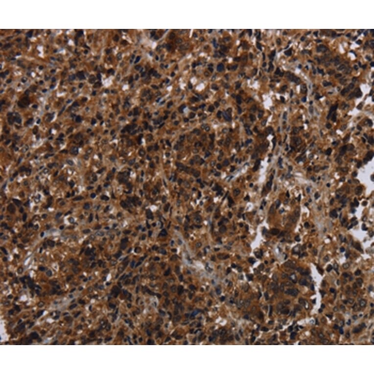 Immunohistochemistry - MAGEE1 Antibody from Signalway Antibody (37710) - Antibodies.com