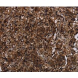 Immunohistochemistry - MAGEE1 Antibody from Signalway Antibody (37710) - Antibodies.com