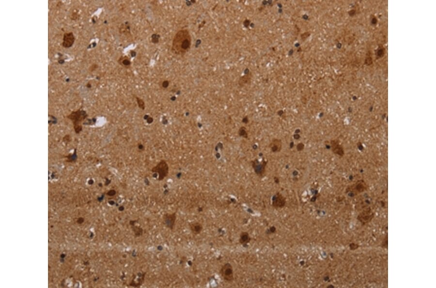 Immunohistochemistry - MAGEE1 Antibody from Signalway Antibody (37710) - Antibodies.com