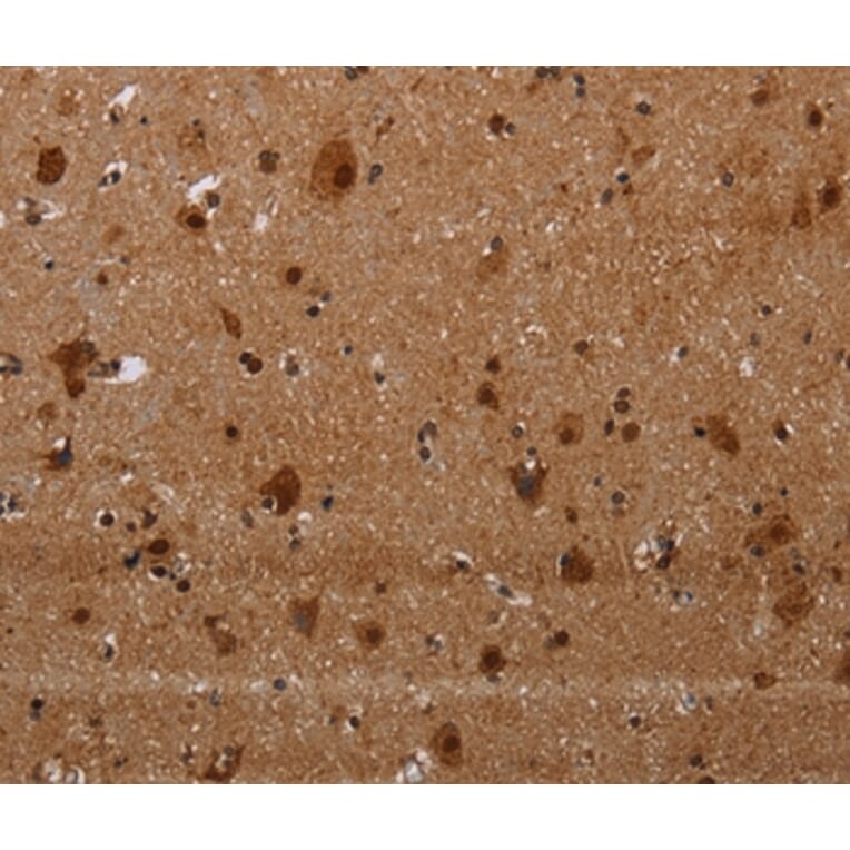 Immunohistochemistry - MAGEE1 Antibody from Signalway Antibody (37710) - Antibodies.com