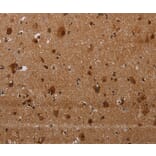 Immunohistochemistry - MAGEE1 Antibody from Signalway Antibody (37710) - Antibodies.com