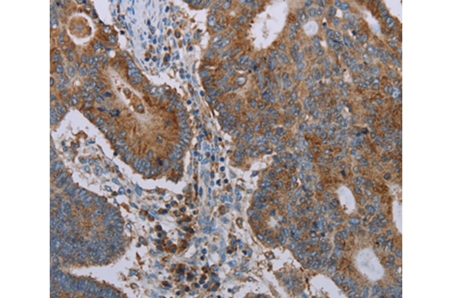 Immunohistochemistry - CYP7A1 Antibody from Signalway Antibody (37729) - Antibodies.com