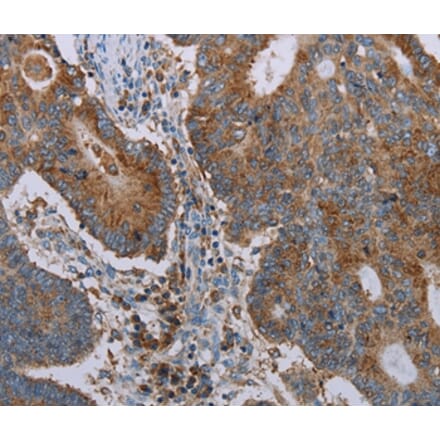 Immunohistochemistry - CYP7A1 Antibody from Signalway Antibody (37729) - Antibodies.com