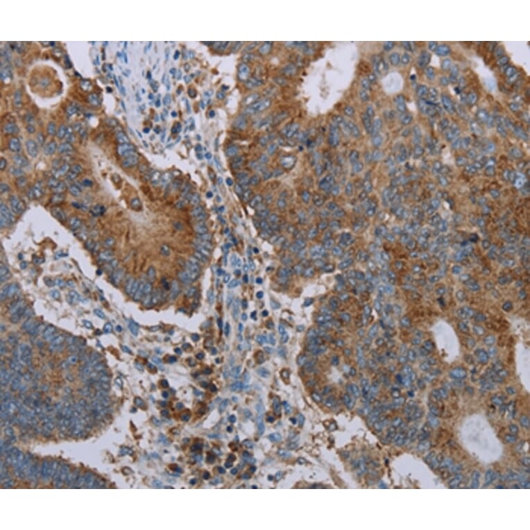 Immunohistochemistry - CYP7A1 Antibody from Signalway Antibody (37729) - Antibodies.com