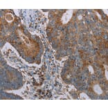 Immunohistochemistry - CYP7A1 Antibody from Signalway Antibody (37729) - Antibodies.com