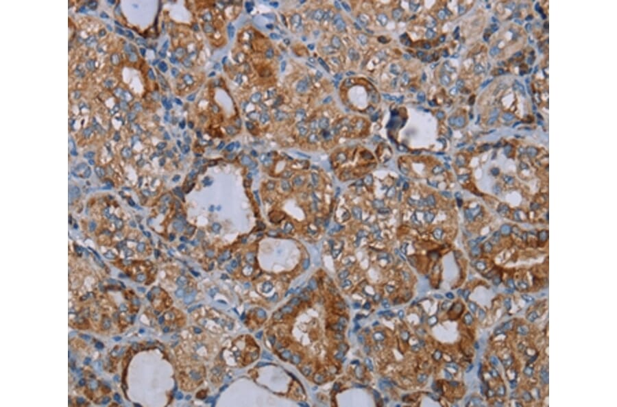 Immunohistochemistry - CYP7A1 Antibody from Signalway Antibody (37729) - Antibodies.com