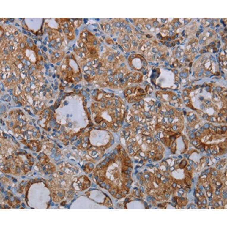 Immunohistochemistry - CYP7A1 Antibody from Signalway Antibody (37729) - Antibodies.com