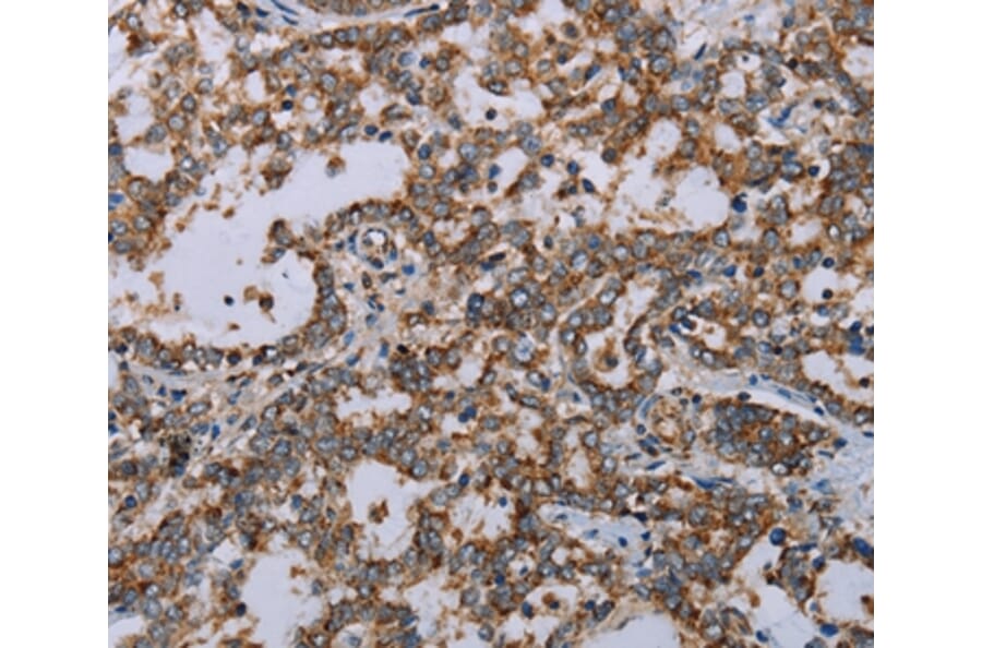 Immunohistochemistry - MMP23B Antibody from Signalway Antibody (37735) - Antibodies.com