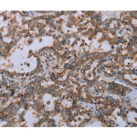 Immunohistochemistry - MMP23B Antibody from Signalway Antibody (37735) - Antibodies.com