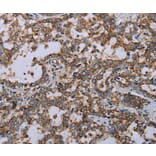 Immunohistochemistry - MMP23B Antibody from Signalway Antibody (37735) - Antibodies.com