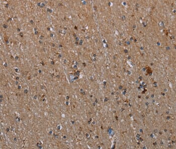 Immunohistochemical analysis of paraffin-embedded Human brain tissue using #37735 at dilution 1/20.
