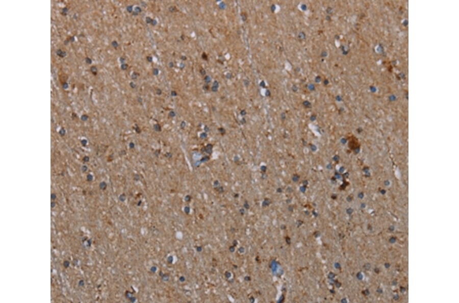 Immunohistochemistry - MMP23B Antibody from Signalway Antibody (37735) - Antibodies.com