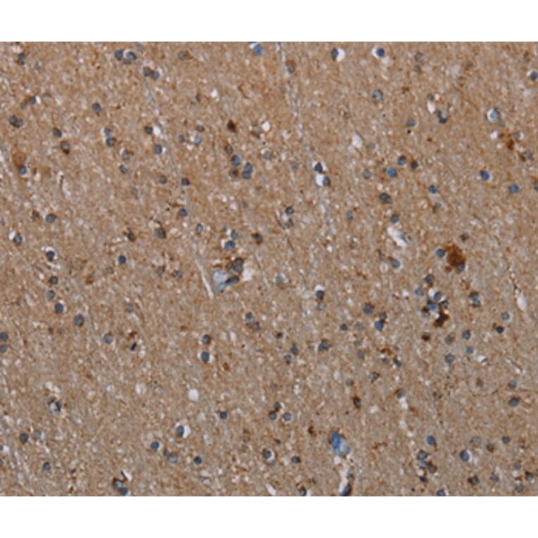 Immunohistochemistry - MMP23B Antibody from Signalway Antibody (37735) - Antibodies.com