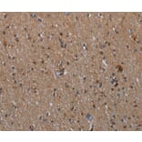 Immunohistochemistry - MMP23B Antibody from Signalway Antibody (37735) - Antibodies.com