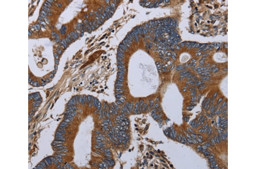 Immunohistochemistry - MT-ND6 Antibody from Signalway Antibody (37742) - Antibodies.com