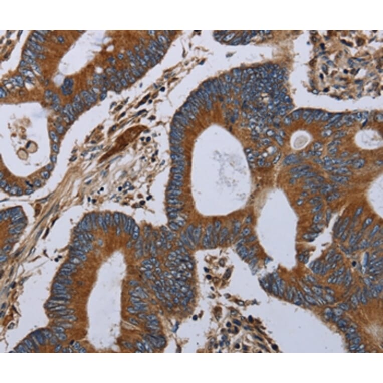 Immunohistochemistry - MT-ND6 Antibody from Signalway Antibody (37742) - Antibodies.com