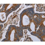 Immunohistochemistry - MT-ND6 Antibody from Signalway Antibody (37742) - Antibodies.com