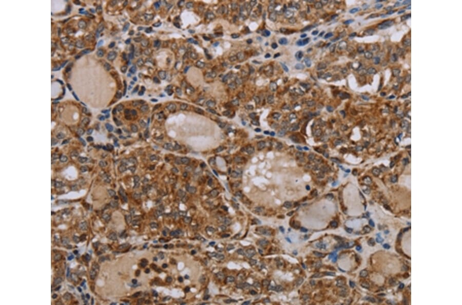 Immunohistochemistry - MT-ND6 Antibody from Signalway Antibody (37742) - Antibodies.com