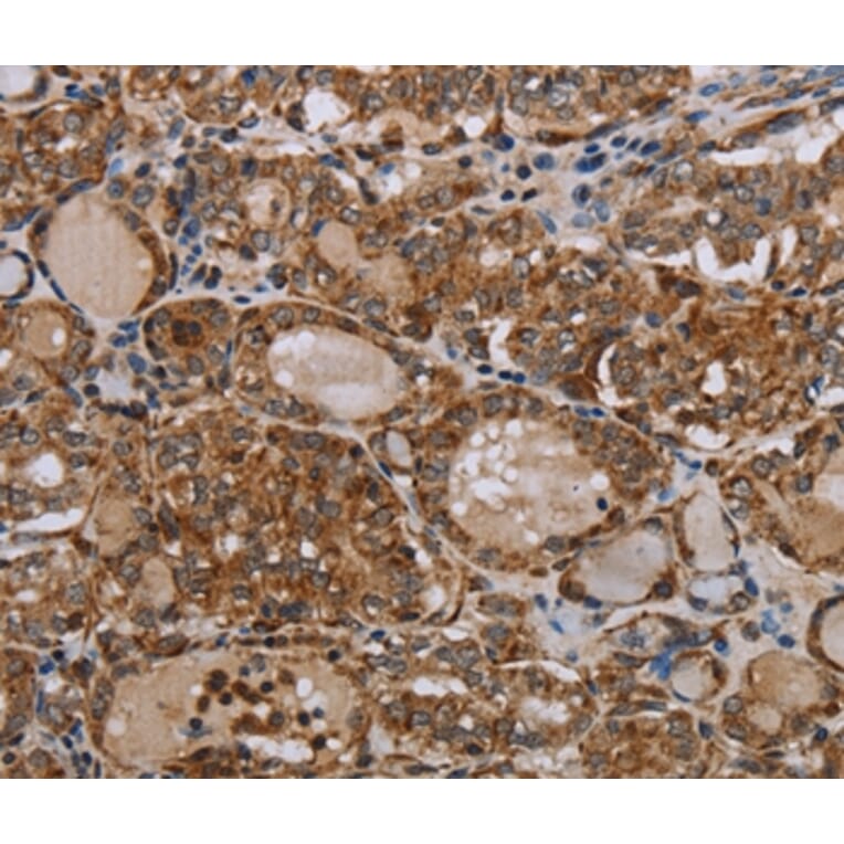 Immunohistochemistry - MT-ND6 Antibody from Signalway Antibody (37742) - Antibodies.com