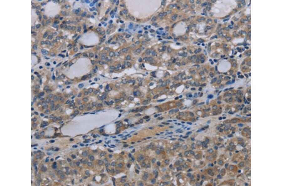 Immunohistochemistry - MT-ND3 Antibody from Signalway Antibody (37743) - Antibodies.com
