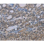 Immunohistochemistry - MT-ND3 Antibody from Signalway Antibody (37743) - Antibodies.com