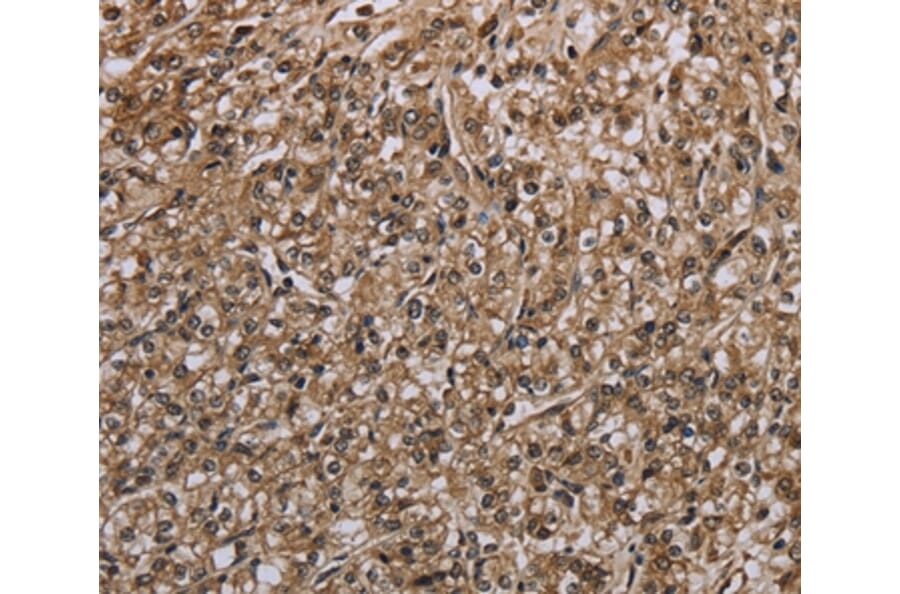 Immunohistochemistry - MYO18B Antibody from Signalway Antibody (37748) - Antibodies.com