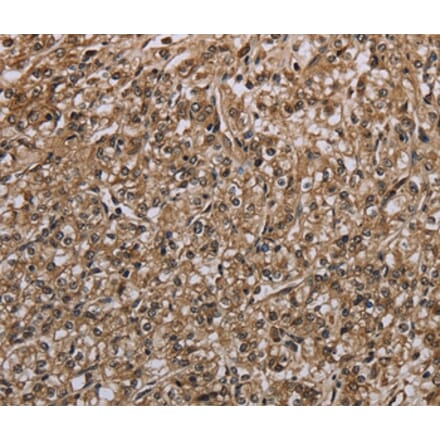 Immunohistochemistry - MYO18B Antibody from Signalway Antibody (37748) - Antibodies.com