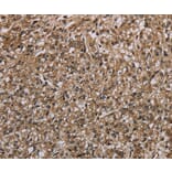 Immunohistochemistry - MYO18B Antibody from Signalway Antibody (37748) - Antibodies.com