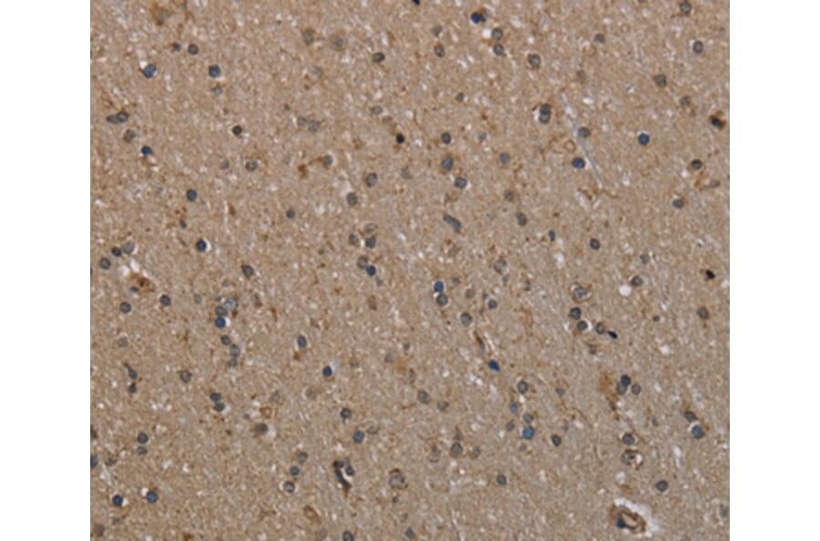 Immunohistochemistry - MYO18B Antibody from Signalway Antibody (37748) - Antibodies.com