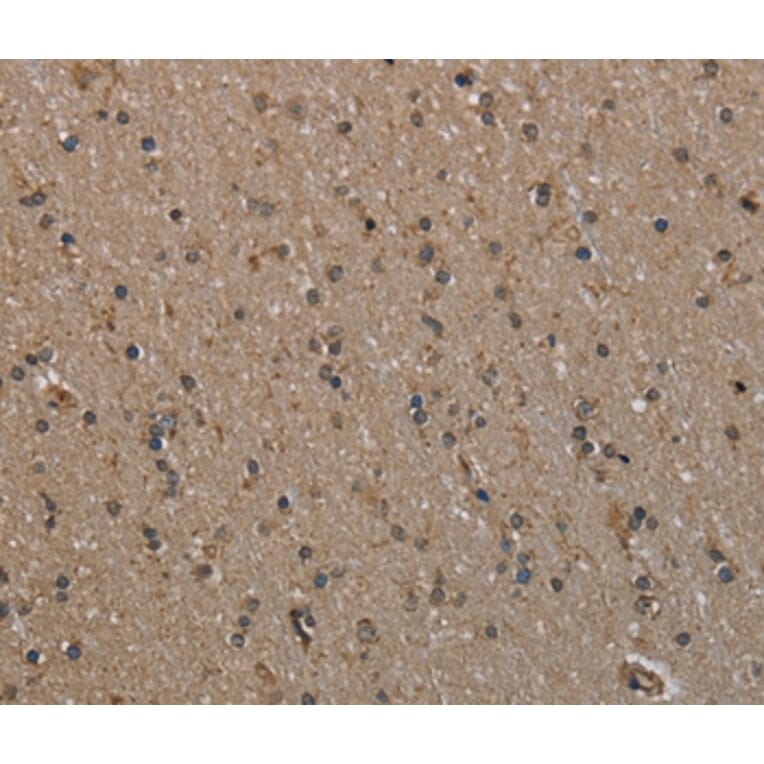 Immunohistochemistry - MYO18B Antibody from Signalway Antibody (37748) - Antibodies.com