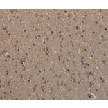 Immunohistochemistry - MYO18B Antibody from Signalway Antibody (37748) - Antibodies.com