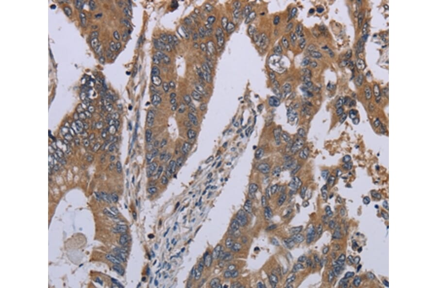 Immunohistochemistry - NLRP12 Antibody from Signalway Antibody (37750) - Antibodies.com