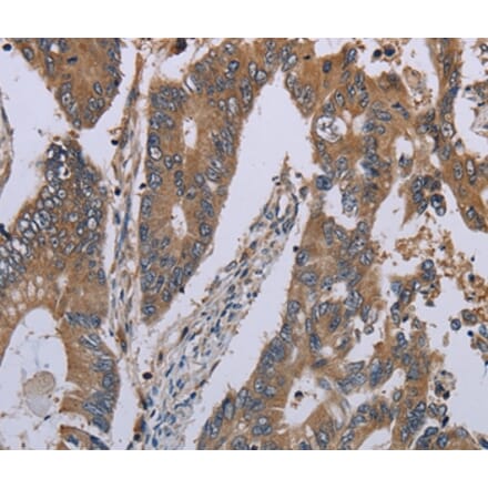 Immunohistochemistry - NLRP12 Antibody from Signalway Antibody (37750) - Antibodies.com