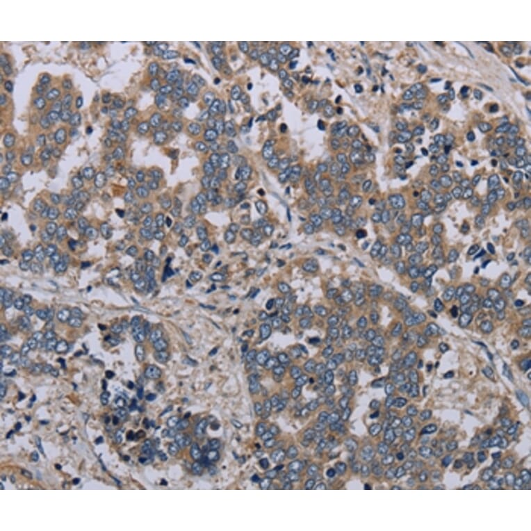Immunohistochemistry - NLRP12 Antibody from Signalway Antibody (37750) - Antibodies.com