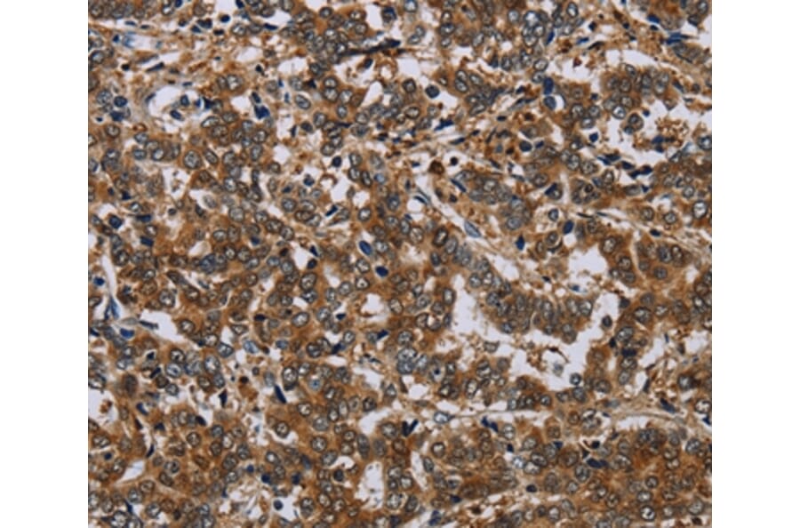 Immunohistochemistry - NCKAP1 Antibody from Signalway Antibody (37754) - Antibodies.com