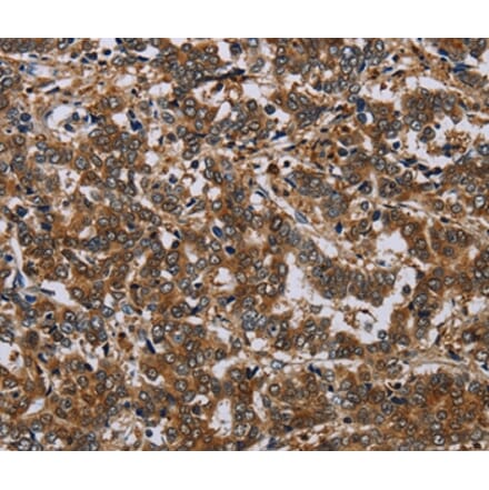 Immunohistochemistry - NCKAP1 Antibody from Signalway Antibody (37754) - Antibodies.com