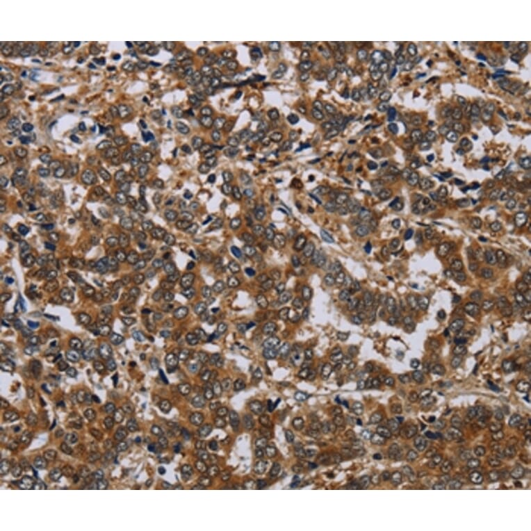 Immunohistochemistry - NCKAP1 Antibody from Signalway Antibody (37754) - Antibodies.com