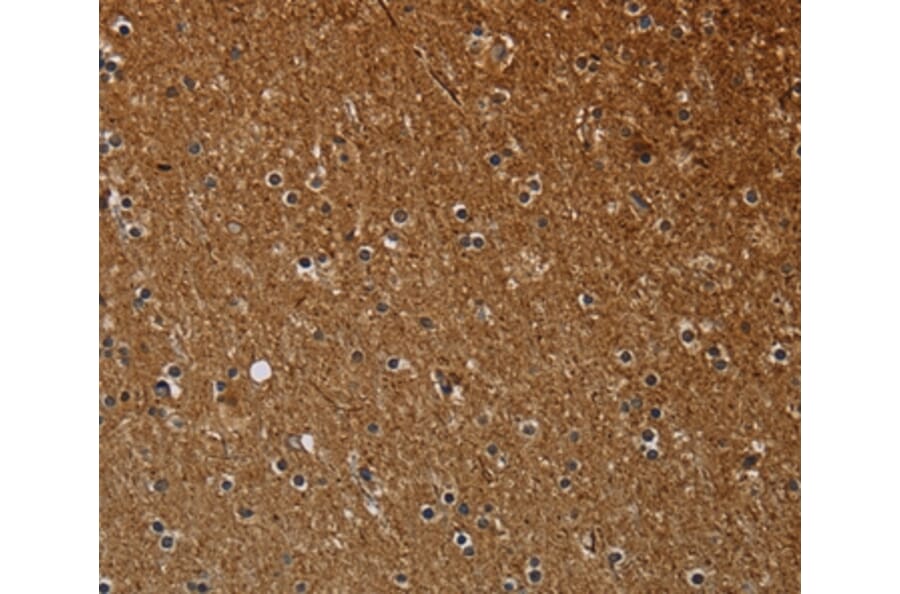 Immunohistochemistry - NCKAP1 Antibody from Signalway Antibody (37754) - Antibodies.com